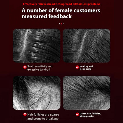 The Prettique™ Scalp Massager